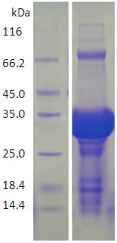 15% SDS-PAGE analysis profiles of purified AB57_3396-23-305 (CBB stained).